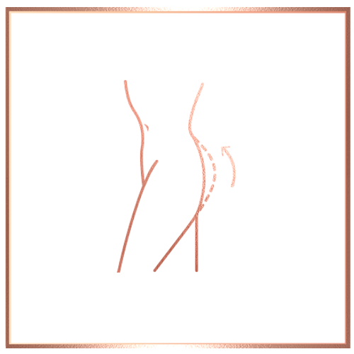 Gluteal Lift