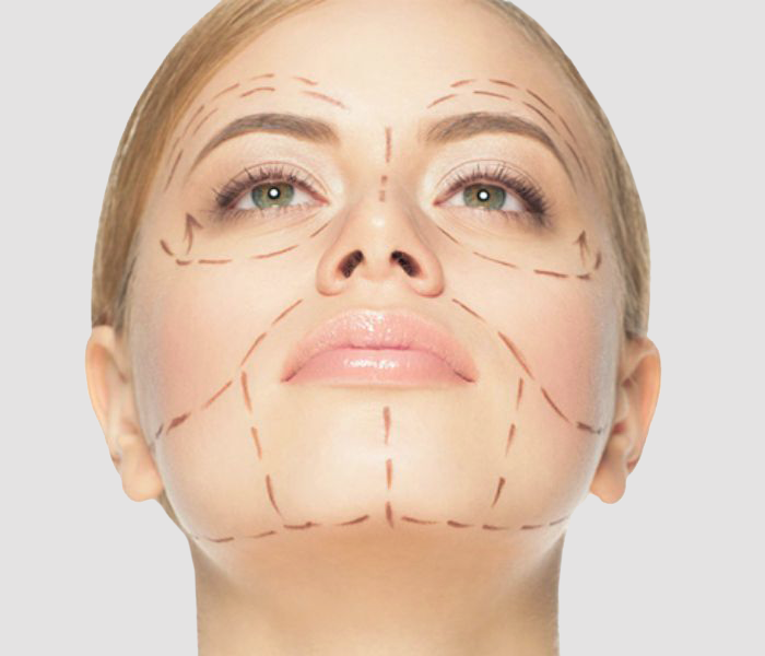 Mexico Facelift: Face Lift Surgery Tijuana, MEX | Rhytidectomy Procedure