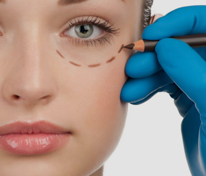 Eyelid Surgery In Tijuana